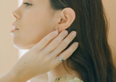 Otoplasty
