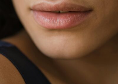 Fillers